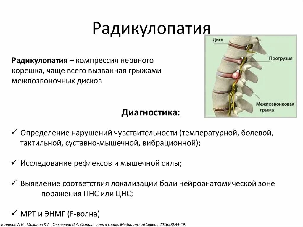 Радикулопатия позвоночника лечение