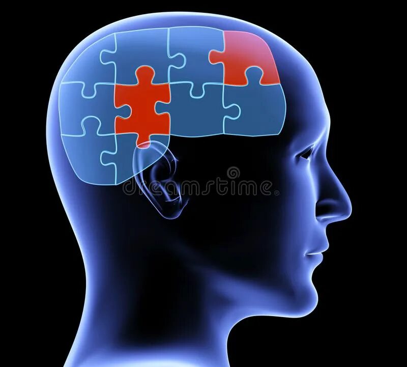 Memory loss