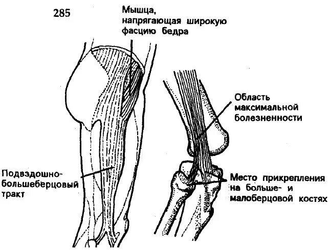 Подвздошно-большеберцовый тракт (tractus iliotibialis). Синдром подвздошно большеберцового тракта. Синдром подвздошно большеберцового тракта. Синдром подвздошно большеберцового тракта. Илиотибиальный тракт синдром.
