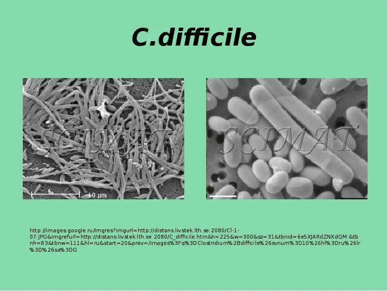 Clostridium difficile что это. Clostridium difficile псевдомембранозного колита.