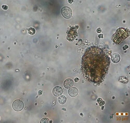 Entamoeba histolytica в микроскоп. Цисты Entamoeba. Entamoeba histolytica микроскопия. Entamoeba coli циста. Entamoeba coli в кале