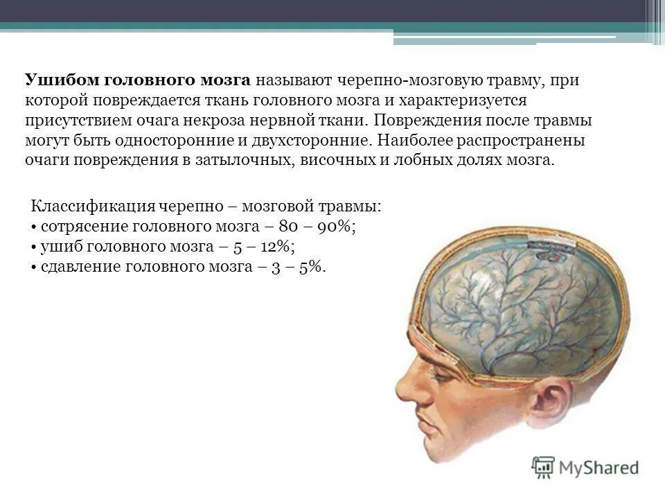 Боли при сотрясении. Черепно-мозговную трамв. Черепно мозговая травма сотрясение. Черепно-мозговая травма ушиб головного мозга.