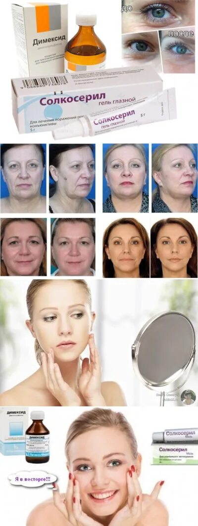Солкосерил для лица от морщин. Солкосерил в косметологии для лица от морщин. Солкосерил мазь мазь от морщин. Солкосерил в косметологии. Солкосерил для косметологии лица отзывы.