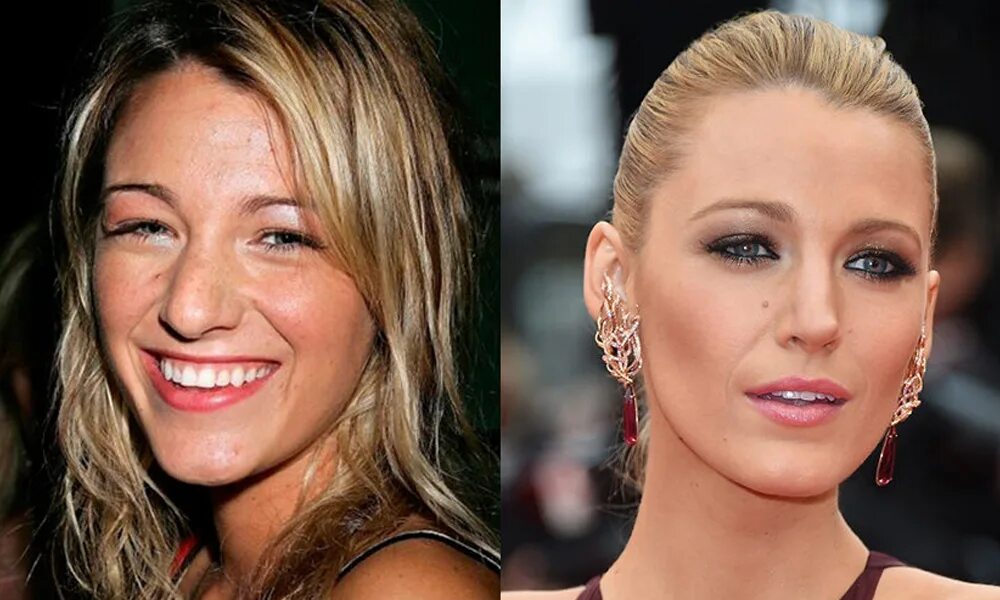 Пластику. Пластику. Донателла версаче в молодости до пластики. Меган фокс пластические операции. Ферги до пластики.