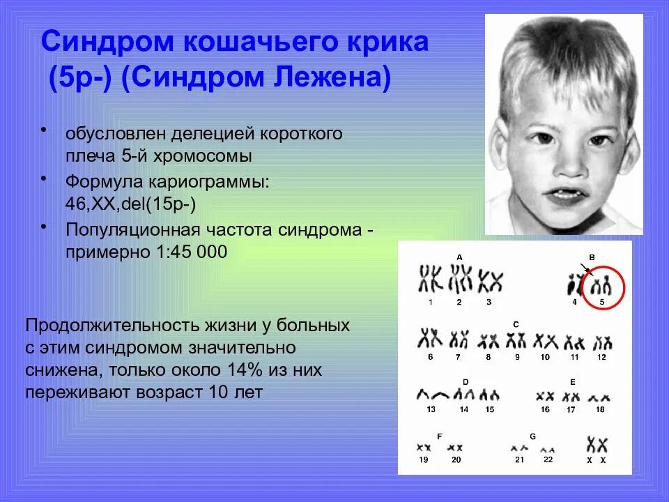 5 заболеваний хромосом