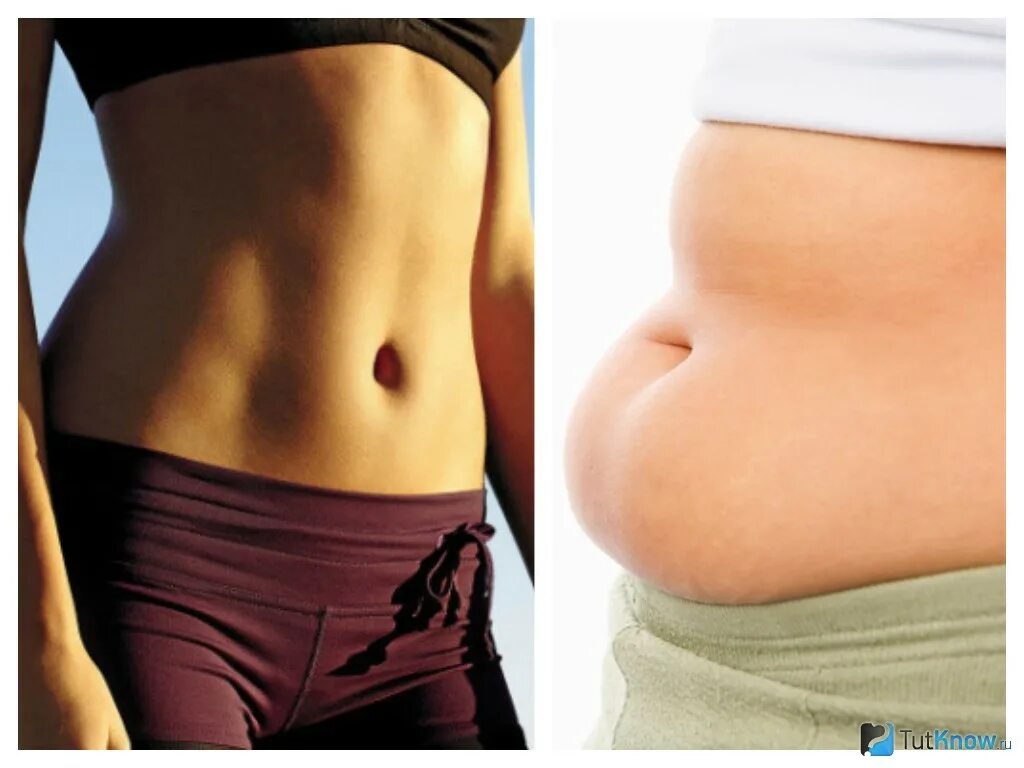 Почему толстеет живот. Мягкий женский живот. Фигура и сладкое. Типы живота у женщин. Лишний вес.