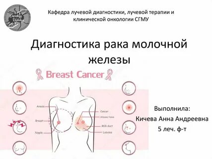 Как распознать онкологию у женщины