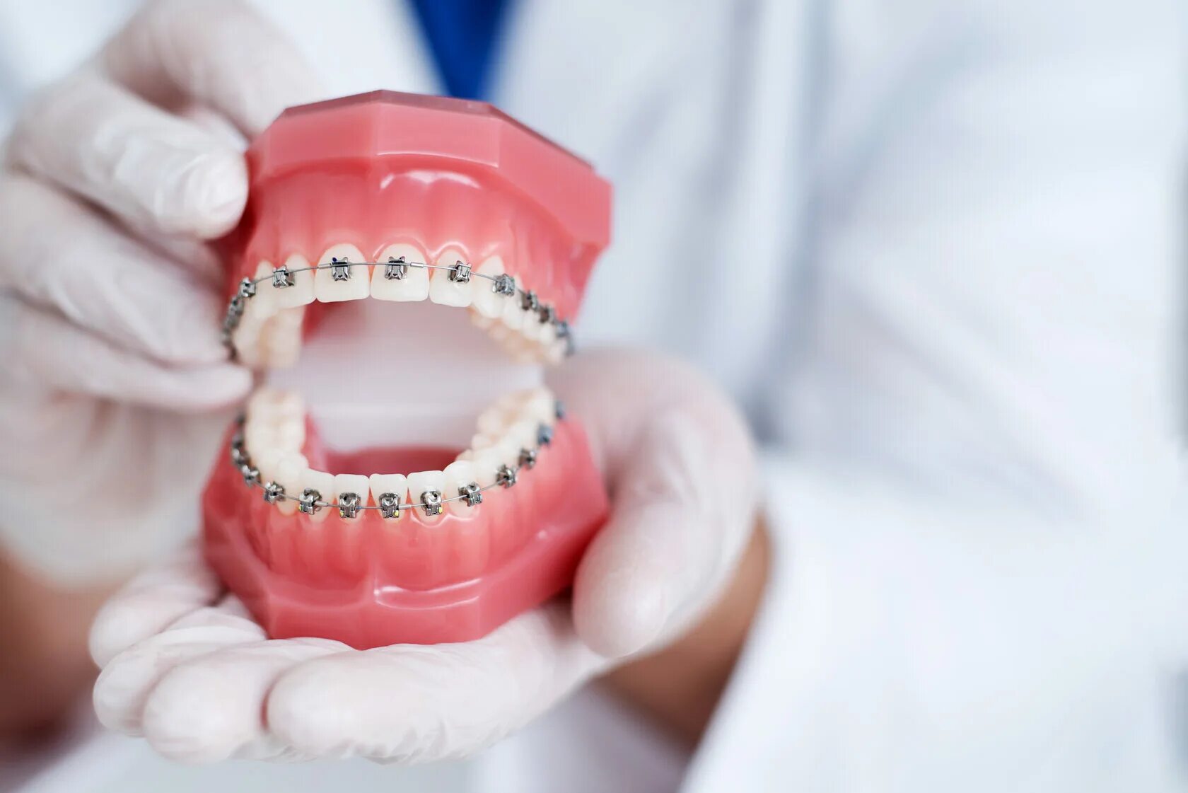 Врач ортодонт что это. Брекеты на зубы ортодонтия. Стоматолог ортодонт. Красивые зубы стоматология.