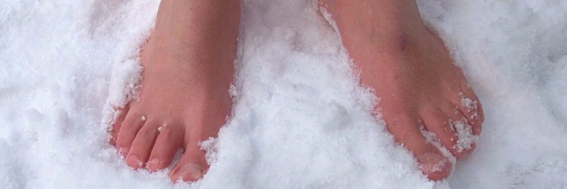 Обморожение конечностей. Обморожение ступней ног. Отморожение нижних конечностей. Холодные бледные ноги