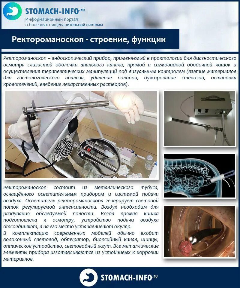 Что такое аноскопия и ректоскопия. Прибор для осмотра прямой кишки. Аноскопия и ректороманоскопия что это. Аппарат для ректороманоскопии. Палец проктолога