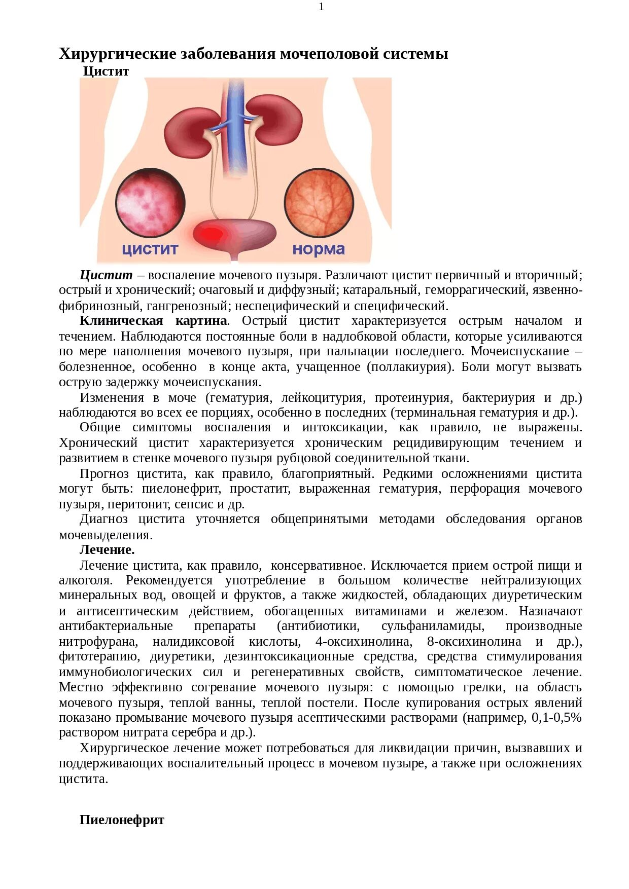 Заболевания мочеполовой системы у мужчин симптомы