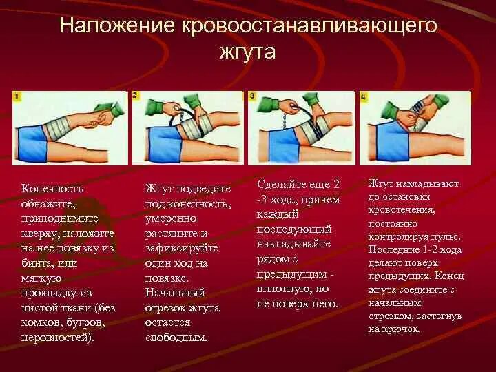 При каких кровотечениях необходимо наложить жгут. Наложение кровоостанавливающего жгута. Наложение кровоостанавливающего жгута на конечность. Наложение кровоостанавливающего жгута на нижнюю конечность. Парябок наложение кровоостанавливающего жкута.