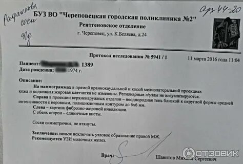 Что значит в заключении маммографии