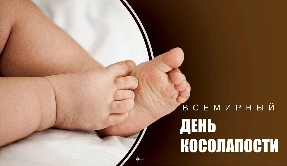 Всемирный день косолапости. Всемирный день косолапости 3 июня. День косолапости 3 июня открытки. 3 июня день людей