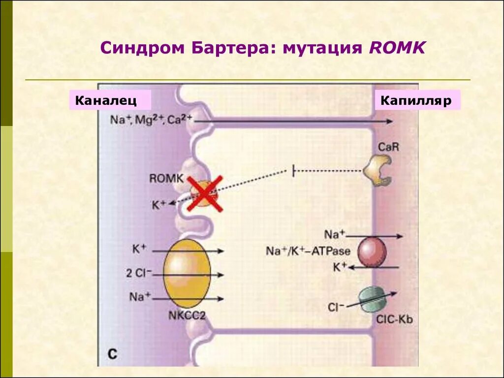Псевдо барттер синдром. Гипокалиемия синдром барттера. синдром барттера у детей. синдром псевдо бартера. синдром барттера патогенез.