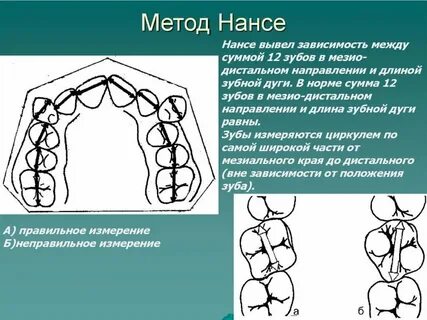 Метод тона