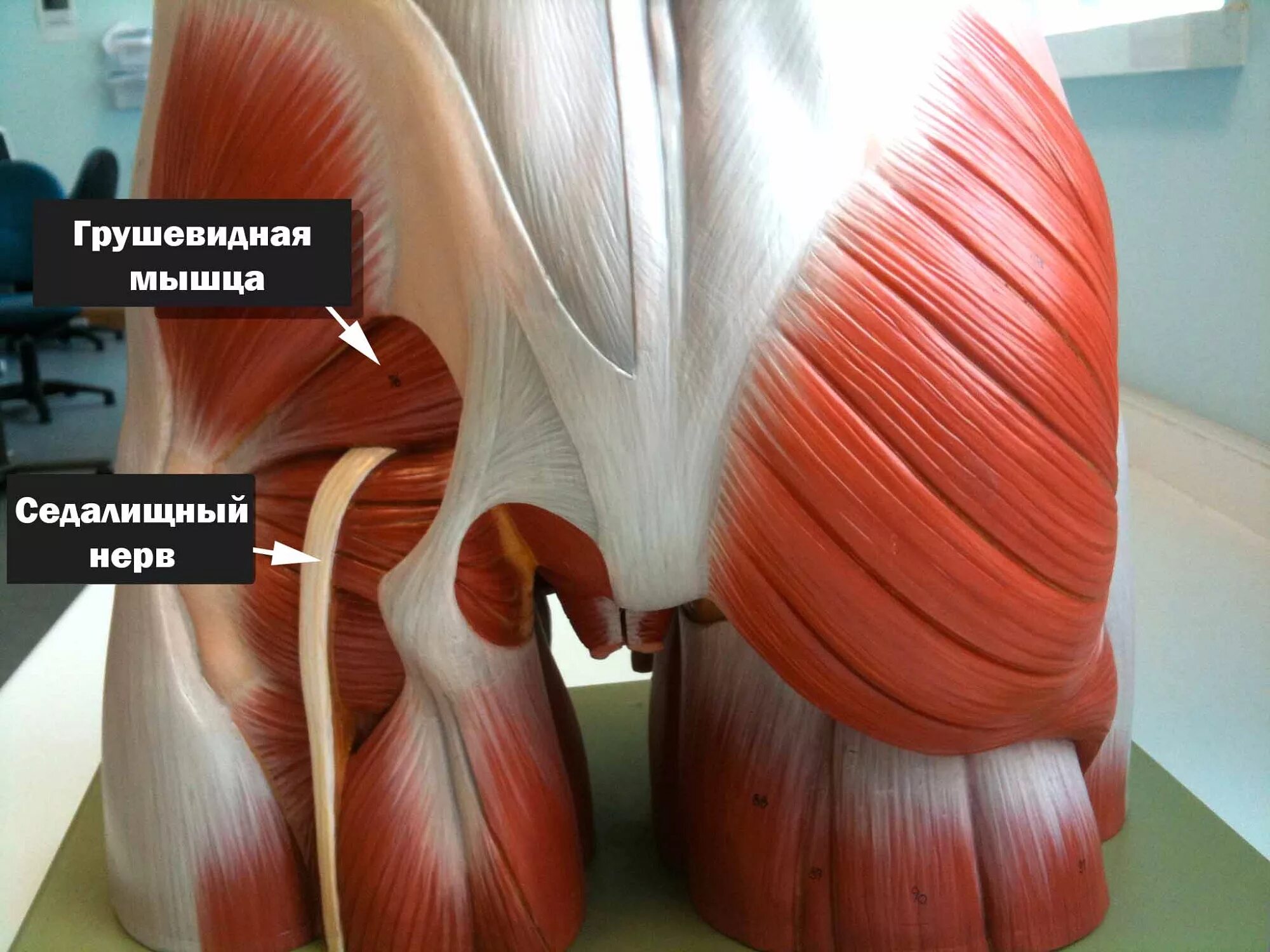 Мышца седалищного нерва. Седалищный нерв. Грушевидная мышца. Мышцы седалищного нерва. Грушевидная ягодичная мышца.