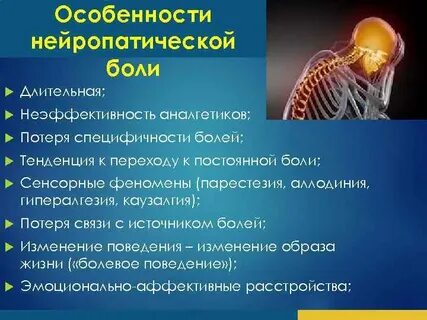 Каузалгия