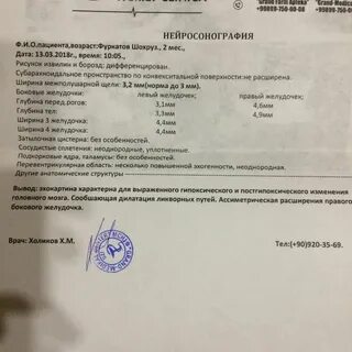 Узи головы расшифровка