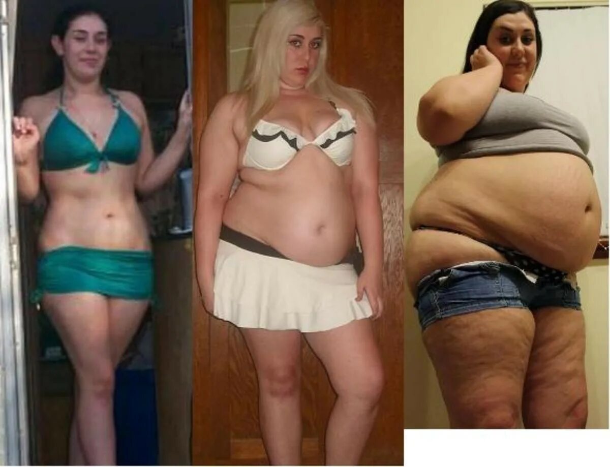 Стала толще. Жирные девушки до и после. Женщины до и после потолстения. Толстые девушки которые толстеют. Люди которые потолстели.