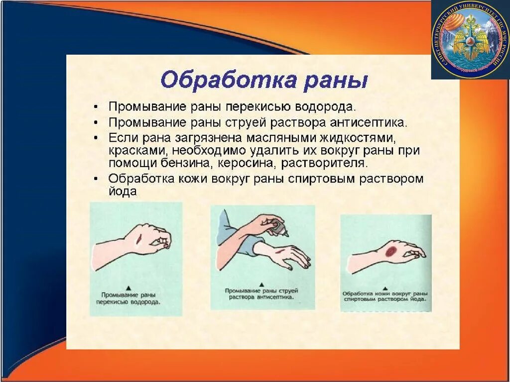 Обработка кожи вокруг раны. Порядок обработки раны. Перекись водорода на рану можно