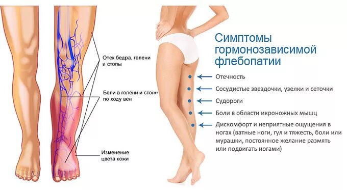 Сильные боли ноги ниже колена причины. Отек голени и стопы на ногах. Боль в нижней части ноги причины.