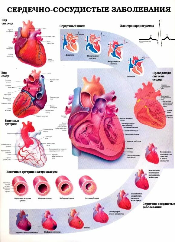 Легкие сердечные заболевания. Сердечно-сосудистые заболевания. Сердечно-сосудистые заболевания плакат. Плакат заболевания сердца.