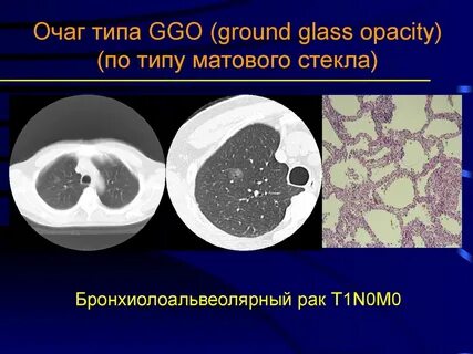 Очаг матового стекла