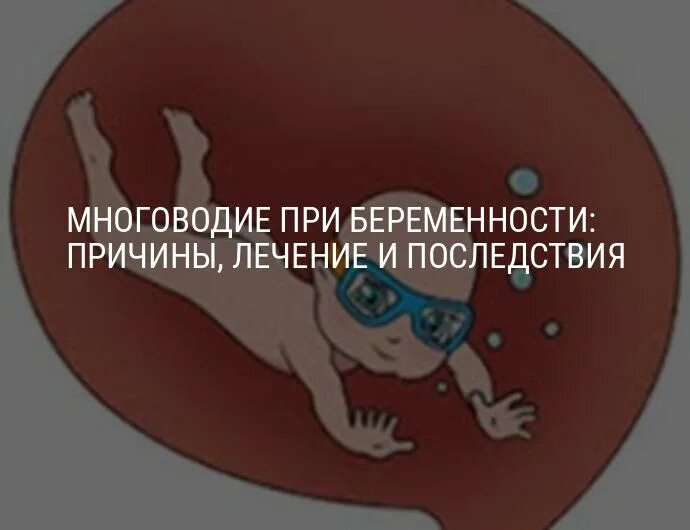 Многоводие у беременных. Многоводие при беременности. многоводия при беременности. многоводие у беременных причины. многоводие при беременности причины.