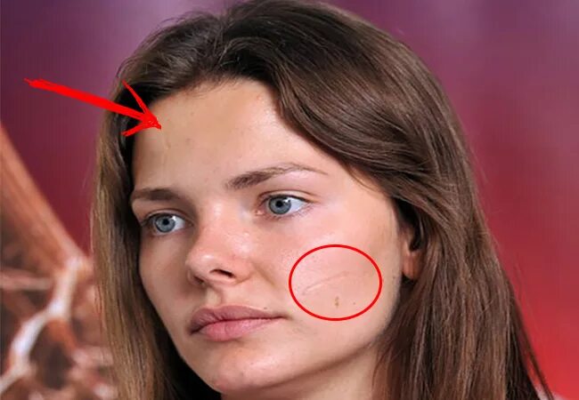 шрам на лице у боярской