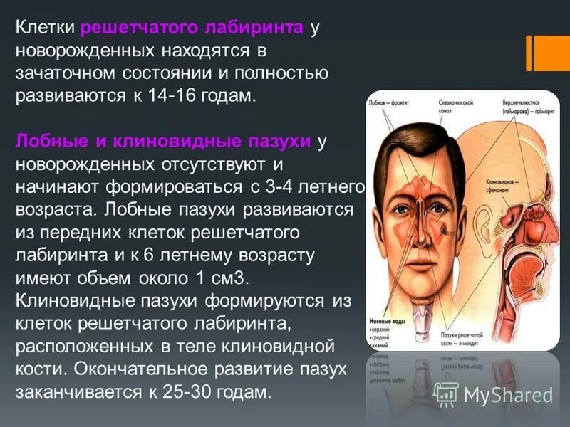 клетки решетчатого лабиринта. ячейки решетчатой кости анатомия. клетки решетчатого лабиринта кости. кости медиальной стенки глазницы. клинико топографическая анатомия решетчатого лабиринта.