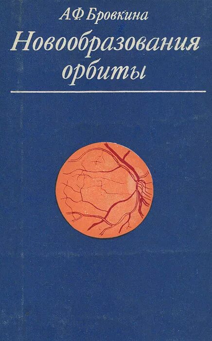 Новообразование орбит. Злокачественные опухоли орбиты. Опухоли орбиты