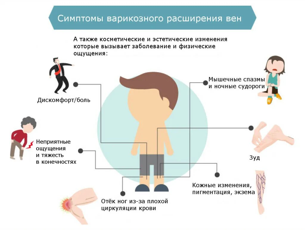 Проявление варикозное расширение вен. Расширение вен симптомы. Симптомы при варикозе вен. Симптомы варикозного расширения вен, причины.