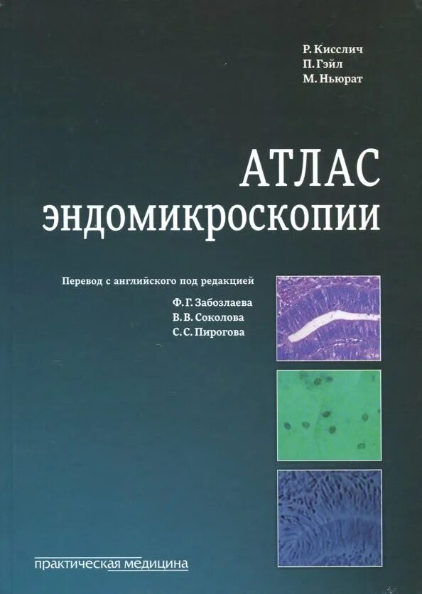 Атлас эндоскопии. Кисслич гэйл ньюрат атлас эндомикроскопии. атлас эндомикроскопии. атлас эндомикроскопии кислич. медицинский атлас микробиология.