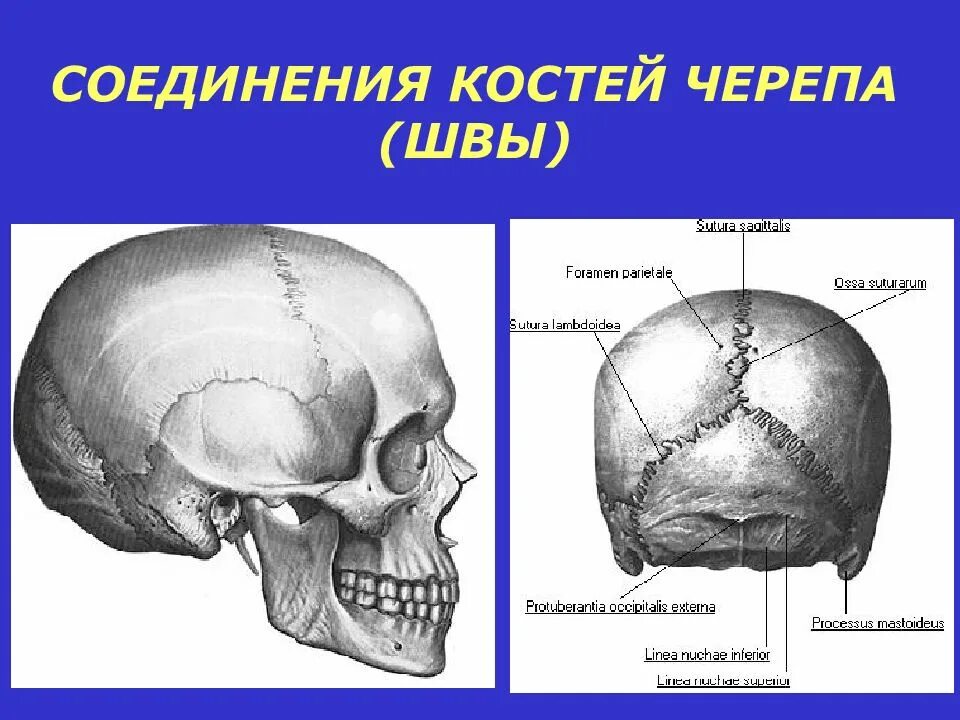 Соединение между лобной и теменной костями. Швы костей черепа анатомия. Кости свода черепа костные швы. Соединение костей свода черепа. Соединение костей черепа анатомия.