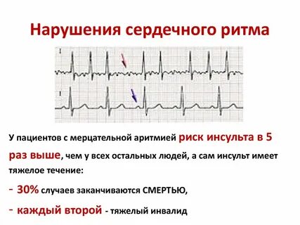 Не в одном ритме