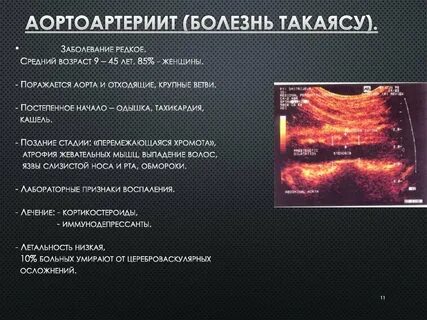 Болезнь такаясу клинические рекомендации