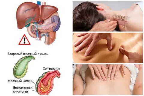 Воспалился желчный что делать: найдено 79 картинок