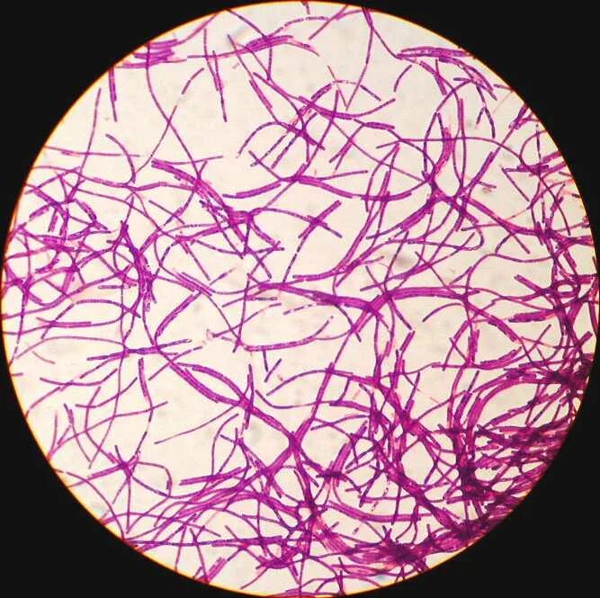 Микроскопия окрашенных. Bacillus anthracis микроскопия. бациллы антракоида. bacillus anthracis морфология. bacillus anthracis мазок.