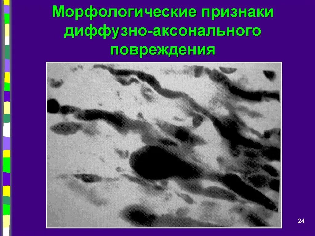 Диффузные повреждения