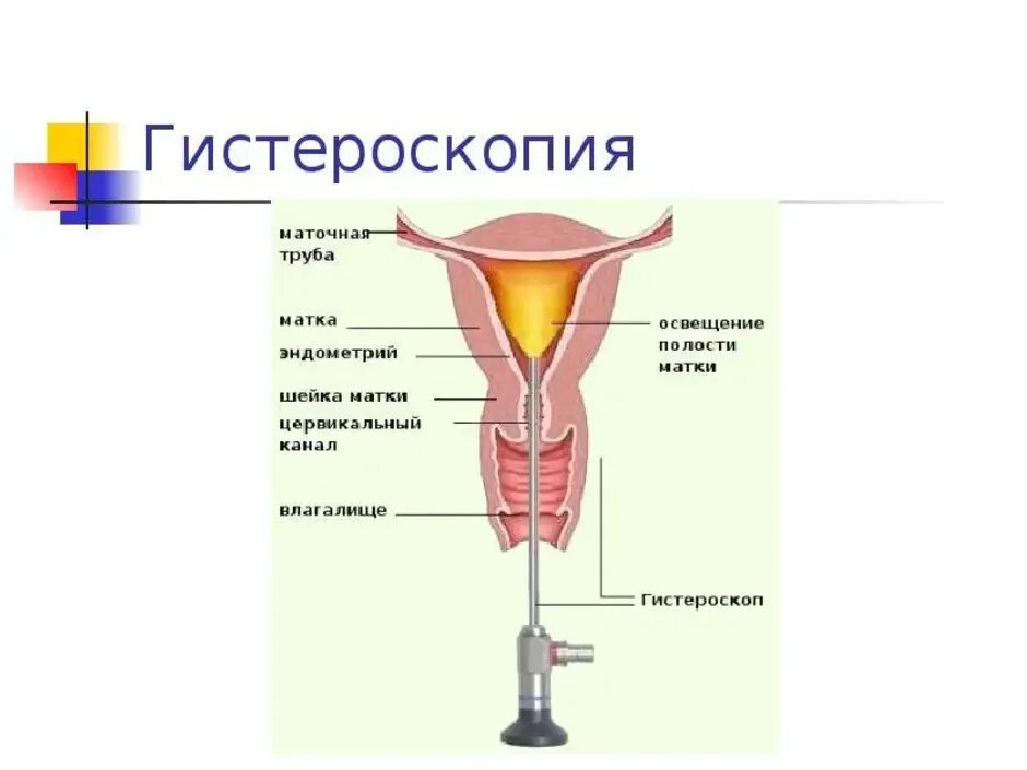 Цервикальный канал и маточный зев. Где находится цервикальный канал в матке. Шейка матки и цервикальный канал. Уретра цервикальный канал влагалище строение. Цервикальный канал размеры