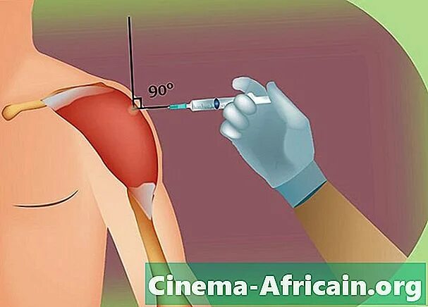 Колоть уколы места. Техника внутримышечной инъекции в дельтовидную мышцу. Внутримышечная инъекция в плечо техника. Техника ВМ инъекции в дельтовидную мышцу. Укол в дельтовидную мышцу плеча.