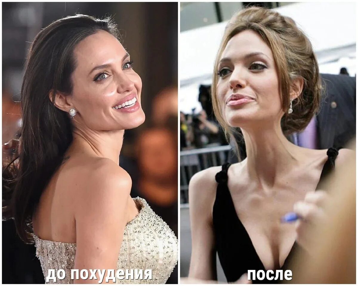 Худая русская актриса. Анджелина Джоли 2020 анорексия. Анджелина Джоли анорексия. Анджелина Джоли сейчас 2020 анорексия. Анджелина Джоли анорексия 2021.