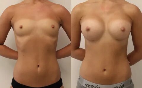 32 b cup boobs off 67% - www.ishawellnesscentre.com.