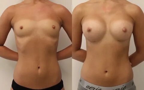 32b boobs naked
