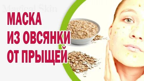 Еда от прыщей на лице