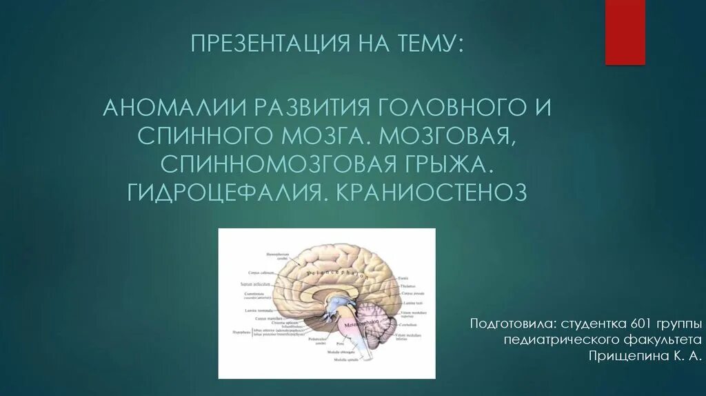 Пороки развития головного мозга. Аномалии развития головного мозга. Аномалии развития головного и спинного мозга. Пороки развития головного мозга у плода.