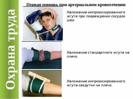 Наложить жгут на шею при артериальном кровотечении