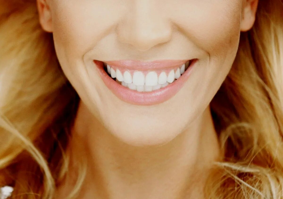 Металлические брекеты. Девушка с красивыми зубами. Девушка улыбается. Сойти улыбка. Девушка с красивыми зубами.