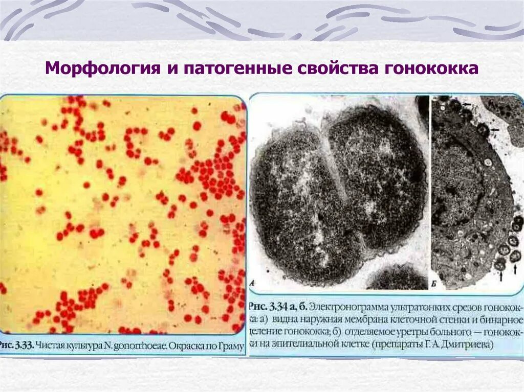 Туберкулез кокки. Нейссерии гонореи микробиология. Нейссерия гонорея морфология. Морфология гонококков микробиология. Нейссерия гонорея микробиология по Граму.